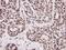 Forkhead Box O3 antibody, PA5-36816, Invitrogen Antibodies, Immunohistochemistry paraffin image 