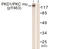 Serine/threonine-protein kinase D1 antibody, LS-C199465, Lifespan Biosciences, Western Blot image 