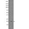 Cathelicidin Antimicrobial Peptide antibody, abx148855, Abbexa, Western Blot image 