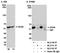 Probable ATP-dependent RNA helicase DDX6 antibody, A300-460A, Bethyl Labs, Immunoprecipitation image 