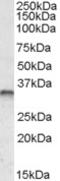 JunB Proto-Oncogene, AP-1 Transcription Factor Subunit antibody, EB09406, Everest Biotech, Western Blot image 