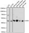 Adenosine Kinase antibody, LS-C749996, Lifespan Biosciences, Western Blot image 