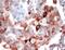 Ribosomal Protein S6 antibody, MA5-16397, Invitrogen Antibodies, Immunohistochemistry paraffin image 