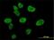 CREB Binding Protein antibody, H00001387-M01, Novus Biologicals, Immunocytochemistry image 