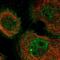 Thioredoxin Interacting Protein antibody, NBP1-84784, Novus Biologicals, Immunofluorescence image 