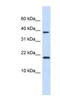 Chromatin Accessibility Complex Subunit 1 antibody, NBP1-80016, Novus Biologicals, Western Blot image 