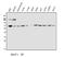 Transketolase antibody, A02197-1, Boster Biological Technology, Western Blot image 