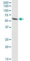 Acyl-CoA Synthetase Family Member 2 antibody, H00080221-B01P, Novus Biologicals, Western Blot image 