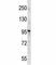 EPH Receptor A1 antibody, F44010-0.4ML, NSJ Bioreagents, Western Blot image 