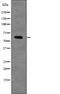 Checkpoint Kinase 2 antibody, PA5-64776, Invitrogen Antibodies, Western Blot image 