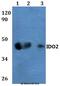 Indoleamine 2,3-Dioxygenase 2 antibody, A06002-1, Boster Biological Technology, Western Blot image 