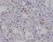 Baculoviral IAP repeat-containing protein 5 antibody, M00379-1, Boster Biological Technology, Immunohistochemistry frozen image 