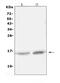 Hemoglobin Subunit Alpha 2 antibody, A00233-1, Boster Biological Technology, Western Blot image 