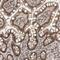 Zinc Finger Homeobox 4 antibody, PA5-54897, Invitrogen Antibodies, Immunohistochemistry paraffin image 