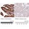 EPS8 Like 2 antibody, NBP1-83613, Novus Biologicals, Immunohistochemistry paraffin image 