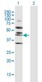 Ribosome Biogenesis Regulator 1 Homolog antibody, H00023212-D01P, Novus Biologicals, Western Blot image 