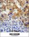 5'-Nucleotidase, Cytosolic IIIB antibody, 56-967, ProSci, Immunohistochemistry paraffin image 