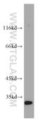 Coagulation Factor XII antibody, 12551-1-AP, Proteintech Group, Western Blot image 