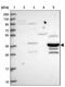 MRN Complex Interacting Protein antibody, NBP2-14417, Novus Biologicals, Western Blot image 