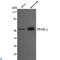 Peroxisome Proliferator Activated Receptor Gamma antibody, LS-C813089, Lifespan Biosciences, Western Blot image 