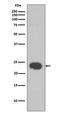 Chromobox 5 antibody, M02780, Boster Biological Technology, Western Blot image 