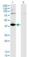 Dihydrodiol Dehydrogenase antibody, H00027294-M03, Novus Biologicals, Western Blot image 