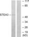 STEAP3 Metalloreductase antibody, LS-C119102, Lifespan Biosciences, Western Blot image 