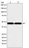 Suppressor Of Variegation 3-9 Homolog 2 antibody, M05361-1, Boster Biological Technology, Western Blot image 