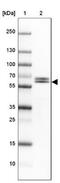 Dihydropyrimidinase Like 4 antibody, NBP2-13937, Novus Biologicals, Western Blot image 