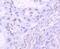 TAR DNA Binding Protein antibody, NBP2-80137, Novus Biologicals, Immunohistochemistry paraffin image 