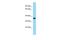 Transmembrane Protein 164 antibody, A17430, Boster Biological Technology, Western Blot image 