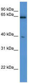 Asparaginase Like 1 antibody, TA335448, Origene, Western Blot image 