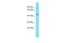 Ankyrin Repeat Domain 40 antibody, A15983, Boster Biological Technology, Western Blot image 