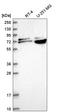 Replication Protein A1 antibody, HPA046497, Atlas Antibodies, Western Blot image 