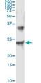 Ubiquitin Conjugating Enzyme E2 T antibody, H00029089-M01, Novus Biologicals, Immunoprecipitation image 