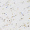 Cholinergic Receptor Muscarinic 5 antibody, LS-C335564, Lifespan Biosciences, Immunohistochemistry paraffin image 