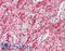 TNF Superfamily Member 13 antibody, LS-B7666, Lifespan Biosciences, Immunohistochemistry paraffin image 