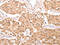 Thioredoxin antibody, CSB-PA281213, Cusabio, Immunohistochemistry paraffin image 