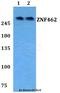 Zinc Finger Protein 462 antibody, A10366, Boster Biological Technology, Western Blot image 