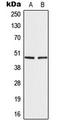 Interferon Regulatory Factor 4 antibody, LS-C354012, Lifespan Biosciences, Western Blot image 