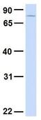 Synapse Defective Rho GTPase Homolog 1 antibody, GTX46972, GeneTex, Western Blot image 