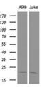 Cyclin Dependent Kinase Inhibitor 3 antibody, MA5-25690, Invitrogen Antibodies, Western Blot image 