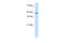 Zinc Finger Protein 213 antibody, A15093, Boster Biological Technology, Western Blot image 