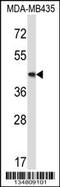 Mitogen-Activated Protein Kinase Kinase 5 antibody, MBS9201410, MyBioSource, Western Blot image 