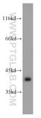 G Protein Subunit Alpha Transducin 1 antibody, 55167-1-AP, Proteintech Group, Western Blot image 