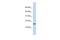 Putative uncharacterized protein encoded by NCRNA00114 antibody, PA5-69384, Invitrogen Antibodies, Western Blot image 