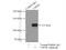 VHL-interacting deubiquitinating enzyme 2 antibody, 17491-1-AP, Proteintech Group, Immunoprecipitation image 