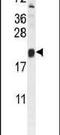 Trafficking Protein Particle Complex 3 antibody, PA5-23684, Invitrogen Antibodies, Western Blot image 