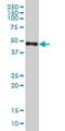 Carboxypeptidase Vitellogenic Like antibody, H00054504-M01, Novus Biologicals, Western Blot image 