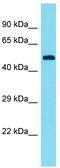 Elongation Factor For RNA Polymerase II 3 antibody, TA343230, Origene, Western Blot image 